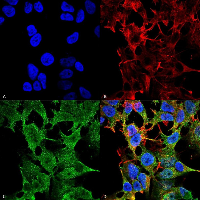 SCN2B Antibody in Immunocytochemistry (ICC/IF)