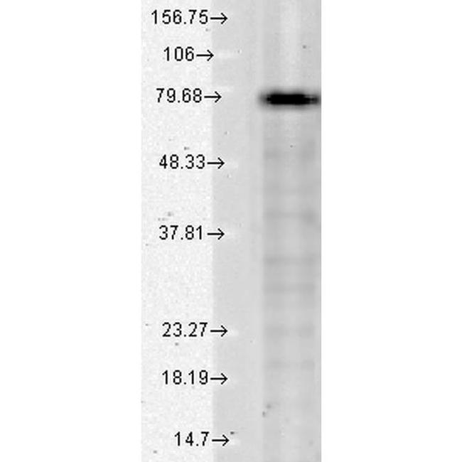 KCNQ1 Antibody in Western Blot (WB)