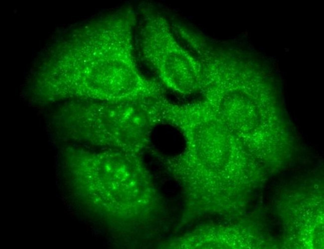 KV3.4 (KCNC4) Antibody in Immunocytochemistry (ICC/IF)