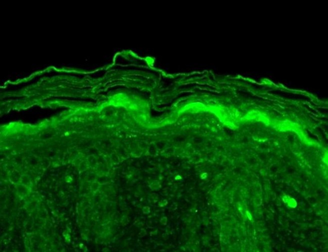 KV3.4 (KCNC4) Antibody in Immunohistochemistry (Paraffin) (IHC (P))