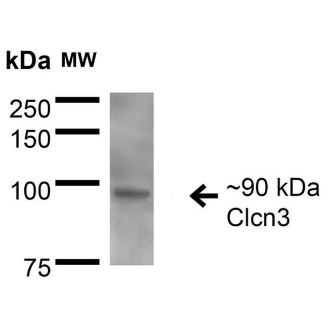 CLCN3 Antibody in Western Blot (WB)