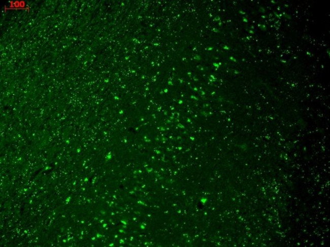 CaV1.3 Antibody in Immunohistochemistry (Paraffin) (IHC (P))