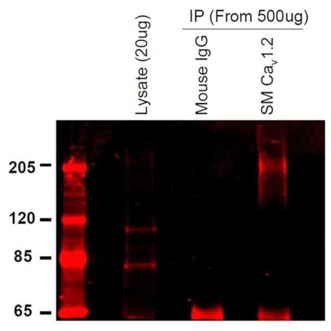 CaV1.2 Antibody in Immunoprecipitation (IP)