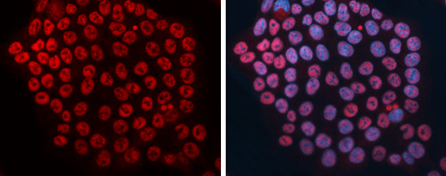 DCK Antibody in Immunocytochemistry (ICC/IF)