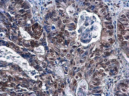 DCK Antibody in Immunohistochemistry (Paraffin) (IHC (P))