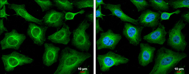 PLS3 Antibody in Immunocytochemistry (ICC/IF)