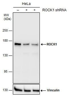 ROCK1 Antibody