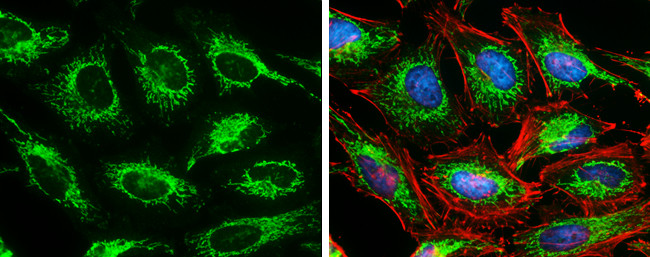 SDHA Monoclonal Antibody (GT20710) (MA5-27782)