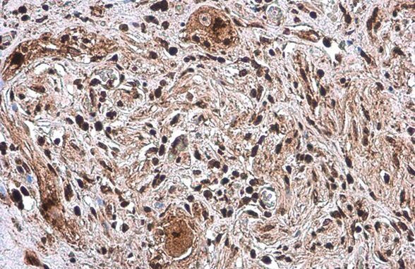 SP1 Antibody in Immunohistochemistry (Paraffin) (IHC (P))