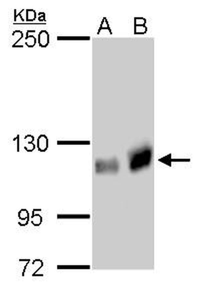GEF-H1 Antibody in Western Blot (WB)