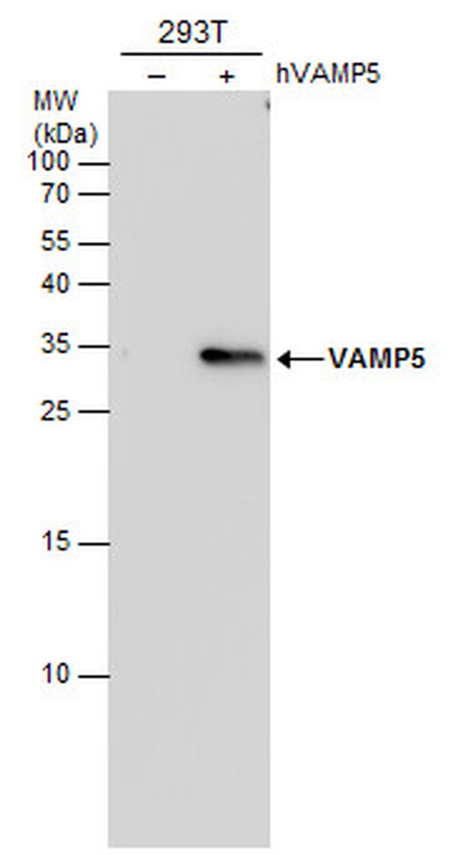 VAMP5 Antibody in Western Blot (WB)