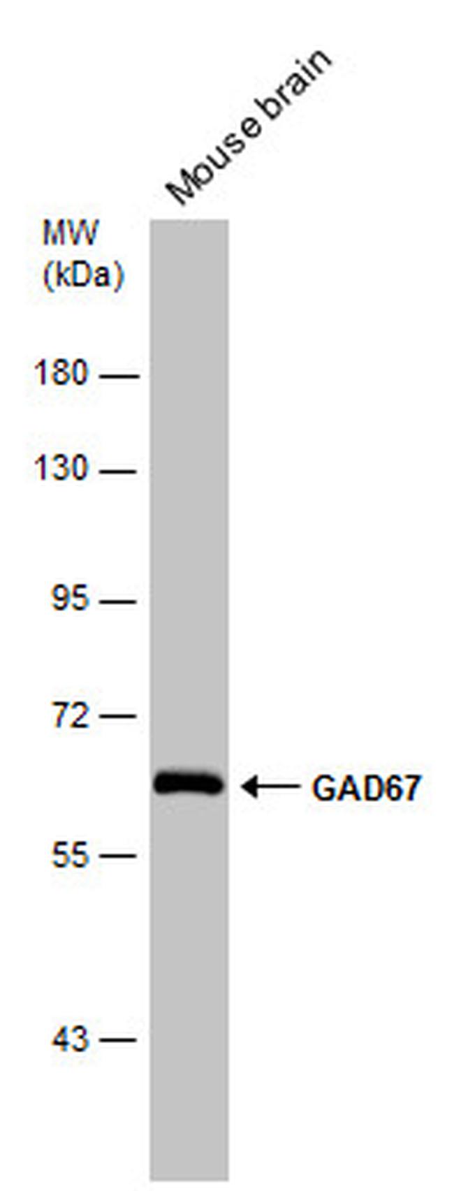 GAD67 Antibody in Western Blot (WB)