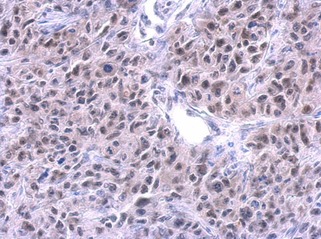 PUF60 Antibody in Immunohistochemistry (Paraffin) (IHC (P))