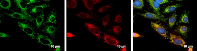 FIS1 Antibody in Immunocytochemistry (ICC/IF)