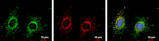 FIS1 Antibody in Immunocytochemistry (ICC/IF)