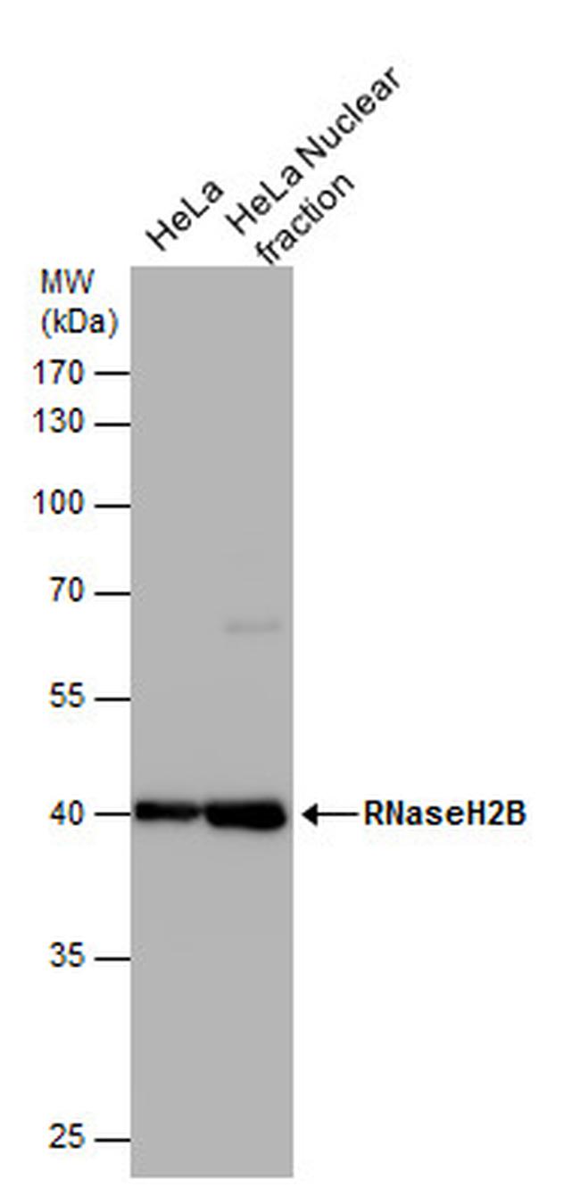 RNaseH2B Antibody in Western Blot (WB)
