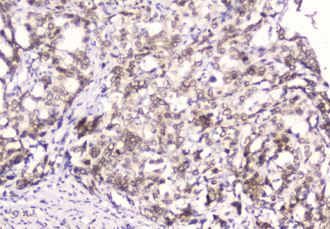 Emerin Antibody in Immunohistochemistry (Paraffin) (IHC (P))