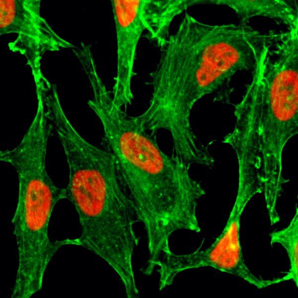 H2BK23ac Antibody in Immunocytochemistry (ICC/IF)