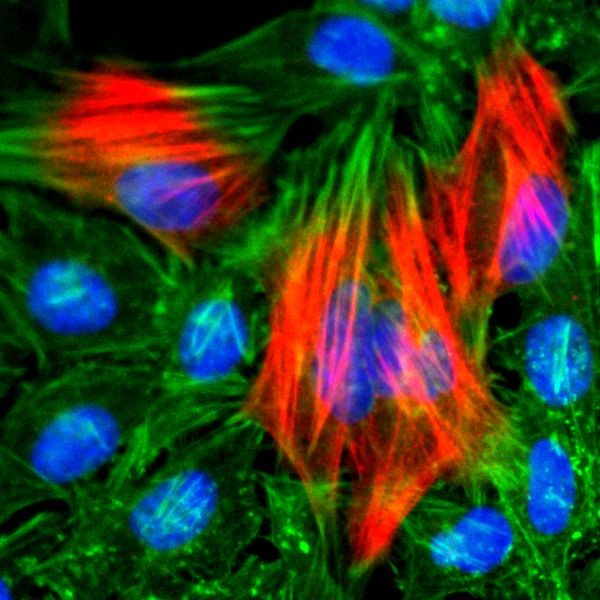 Calponin 1 Antibody in Immunocytochemistry (ICC/IF)