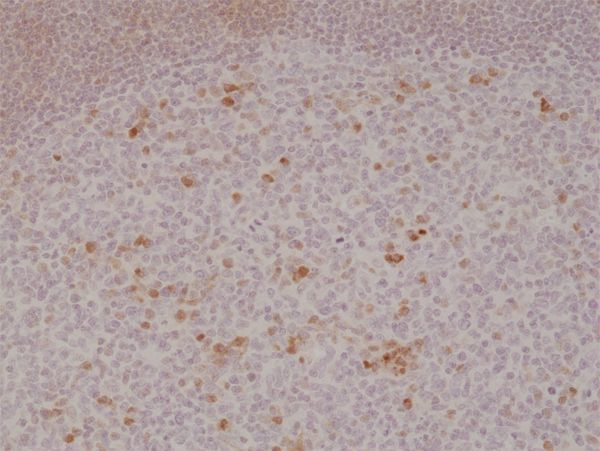 OX40 (CD134) Antibody in Immunohistochemistry (Paraffin) (IHC (P))