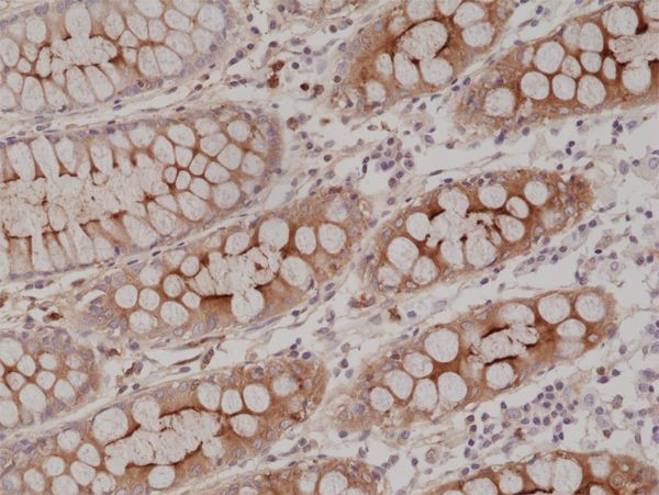 CD66e (CEA) Antibody in Immunohistochemistry (Paraffin) (IHC (P))