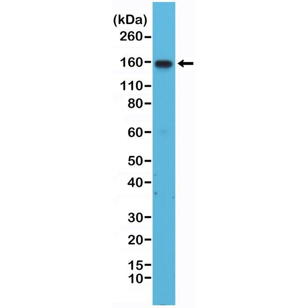 CD49d (Integrin alpha 4) Antibody in Western Blot (WB)