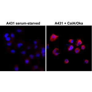 Phosphothreonine Antibody in Immunocytochemistry (ICC/IF)