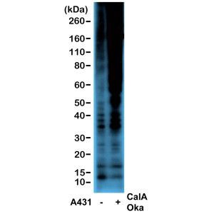 Phosphothreonine Antibody in Western Blot (WB)