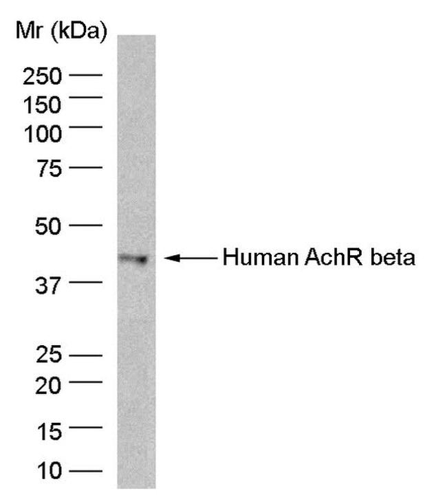 CHRNB1 Antibody in Western Blot (WB)