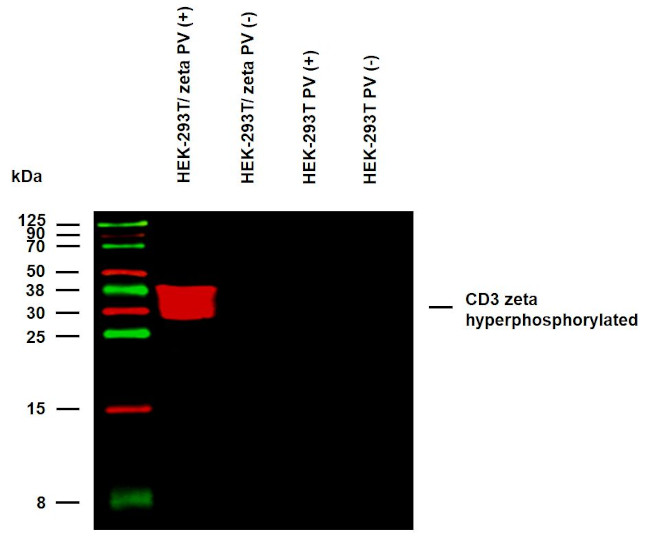 Phospho-CD247 (CD3 zeta) (Tyr142) Antibody in Western Blot (WB)