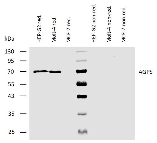 AGPS Antibody in Western Blot (WB)