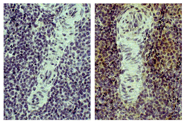 CD4 Antibody in Immunohistochemistry (Paraffin) (IHC (P))