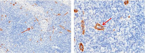 ADAM15 Antibody in Immunohistochemistry (Paraffin) (IHC (P))