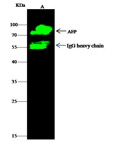 AFP Antibody in Immunoprecipitation (IP)