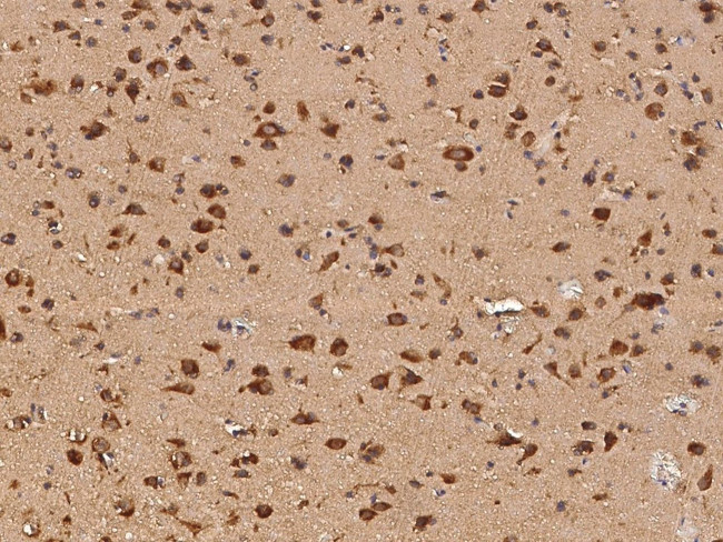 EMAP II Antibody in Immunohistochemistry (Paraffin) (IHC (P))