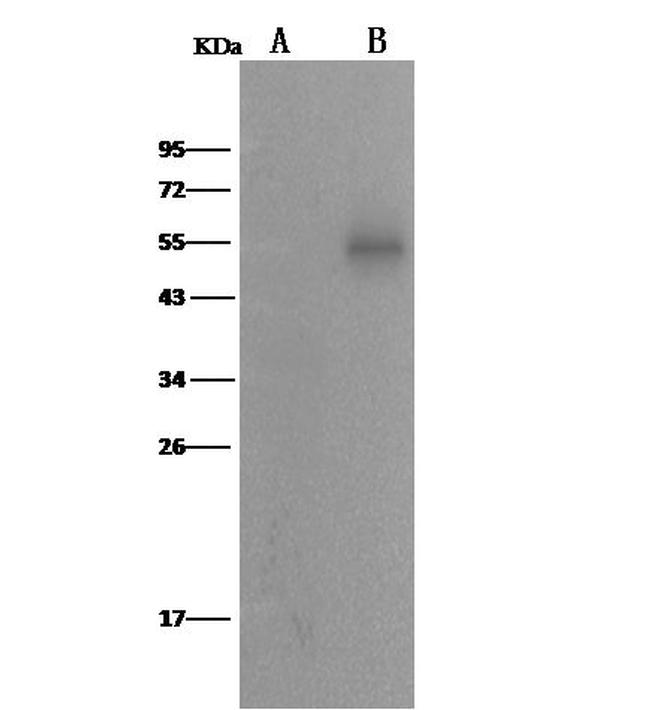 ALDH7A1 Antibody in Western Blot (WB)