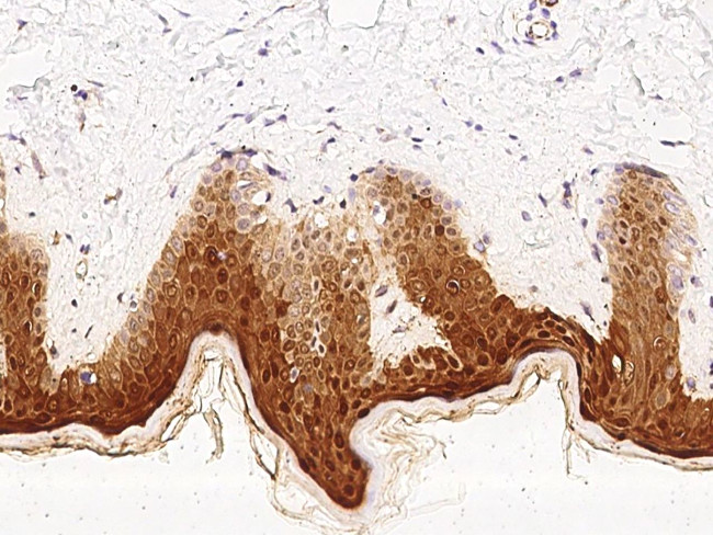 Caspase 14 Antibody in Immunohistochemistry (Paraffin) (IHC (P))