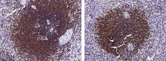 CD19 Antibody in Immunohistochemistry (Paraffin) (IHC (P))