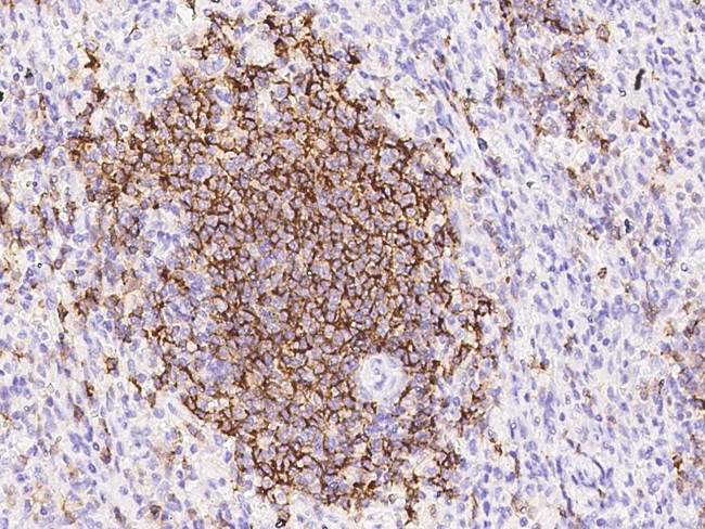 CD19 Antibody in Immunohistochemistry (Paraffin) (IHC (P))