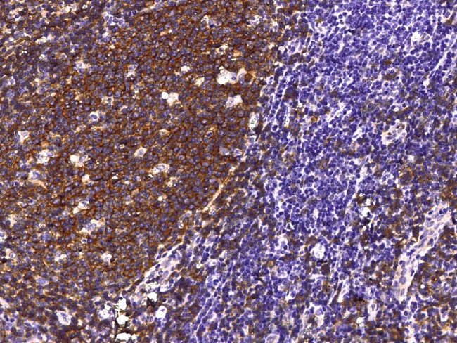 CD19 Antibody in Immunohistochemistry (Paraffin) (IHC (P))