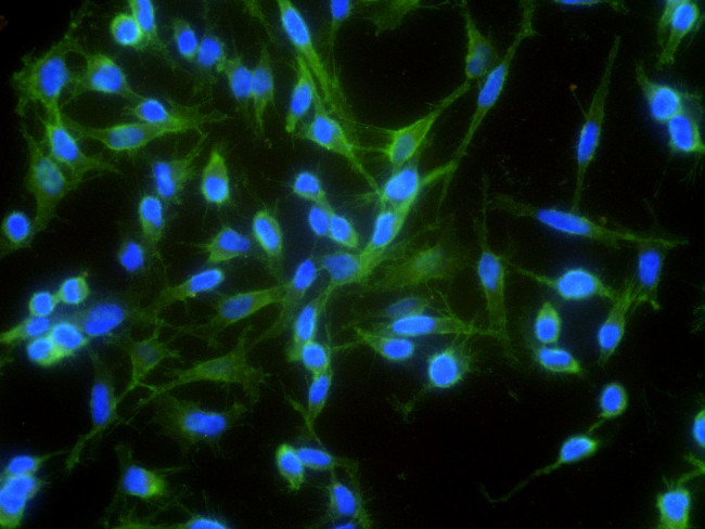 N-cadherin Antibody in Immunocytochemistry (ICC/IF)