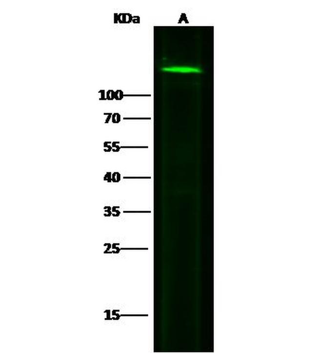 N-cadherin Antibody in Western Blot (WB)