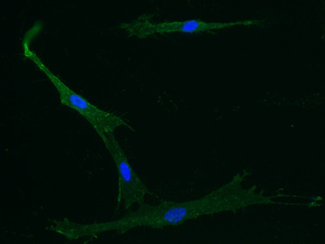 CD105 Antibody in Immunocytochemistry (ICC/IF)