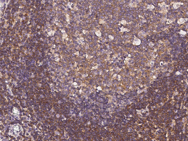 IRE1 alpha Antibody in Immunohistochemistry (Paraffin) (IHC (P))