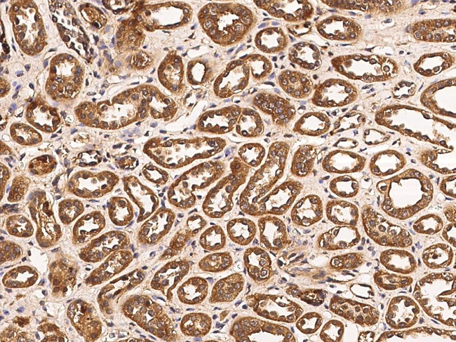 FGFR3 Antibody in Immunohistochemistry (Paraffin) (IHC (P))