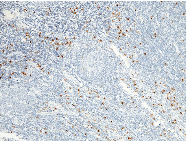 Granzyme B Recombinant Monoclonal Antibody (2) (MA5-29315)
