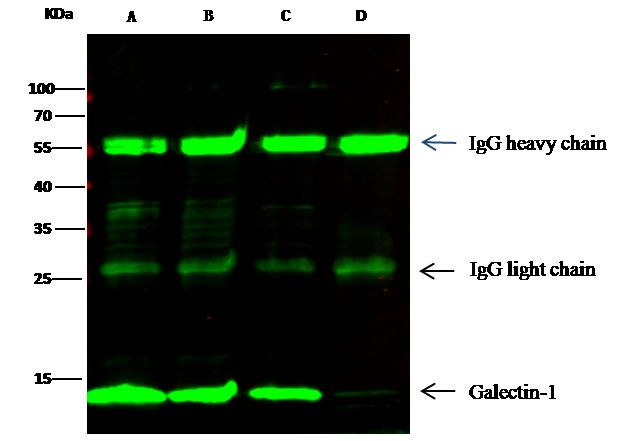 Galectin 1 Antibody in Immunoprecipitation (IP)