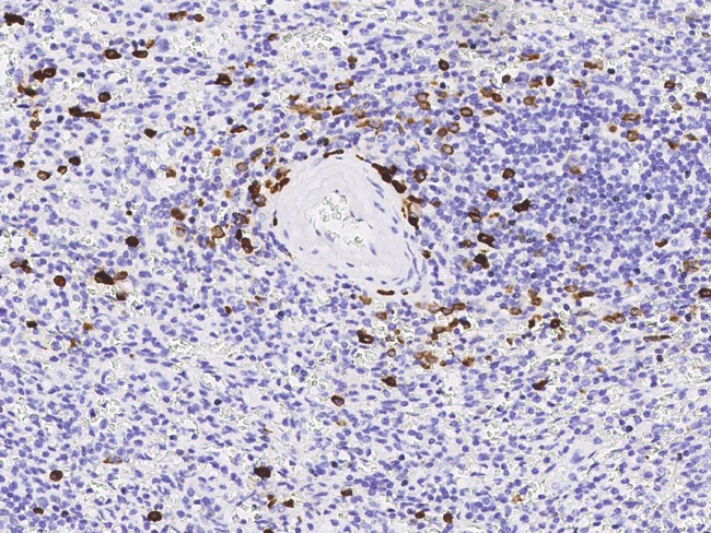 MZB1 Antibody in Immunohistochemistry (Paraffin) (IHC (P))