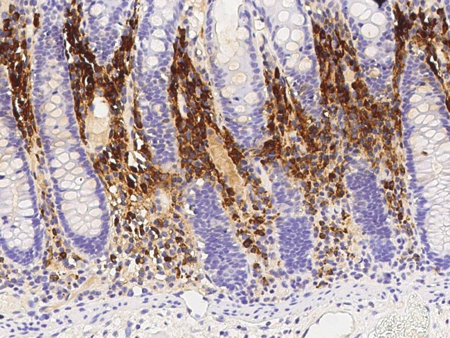 MZB1 Antibody in Immunohistochemistry (Paraffin) (IHC (P))