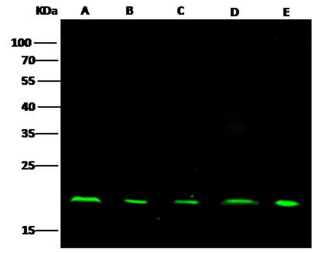 NME1 Antibody in Western Blot (WB)